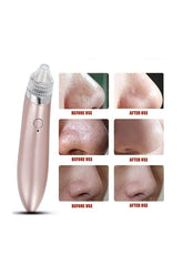 Derma Suction Blackhead Acne Oil Remover Face Pore Cleaner